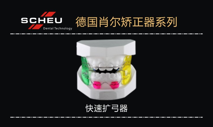快速擴弓器