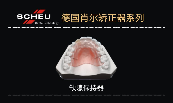 間隙保持器