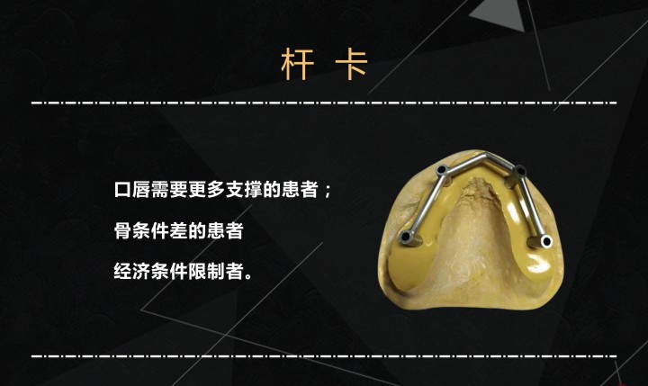 桿卡.jpg