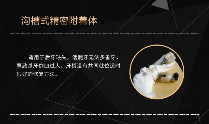 網站內頁-(精密附著體）.jpg